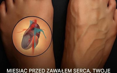 Jakie są objawy ostrzegawcze zawału serca?