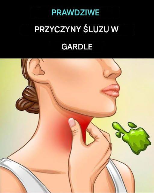 Prawdziwe przyczyny ciągłego zalegania flegmy i śluzu w gardle i jak się tego pozbyć!