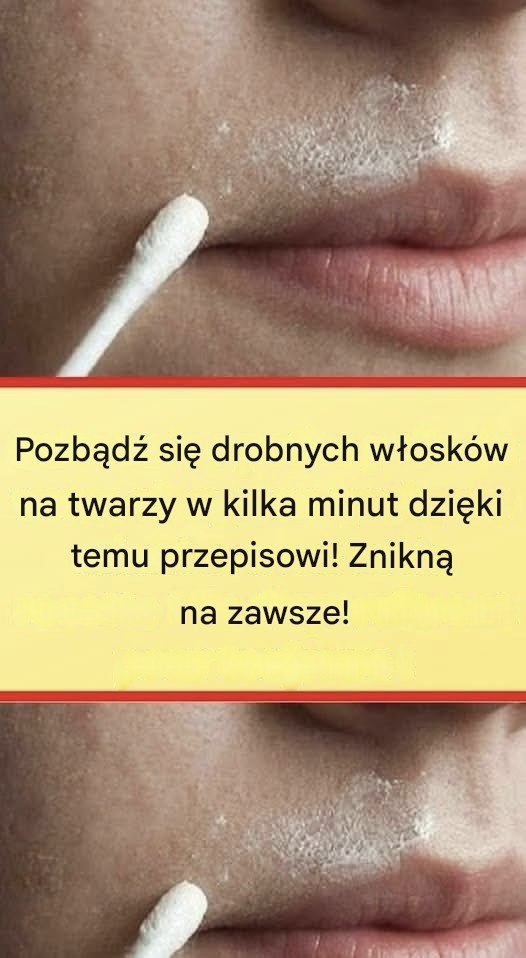 Ta naturalna receptura na stałe usunie włoski na twarzy