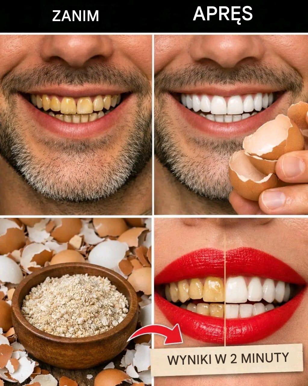 Po 5 minutach żółty kolor zębów zmienia się na perłowo-biały i błyszczący 🥚 – Metoda w pierwszym komentarzu