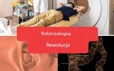Nowa metoda: Kolonoskopia nie będzie już badaniem inwazyjnym. (1/2)
