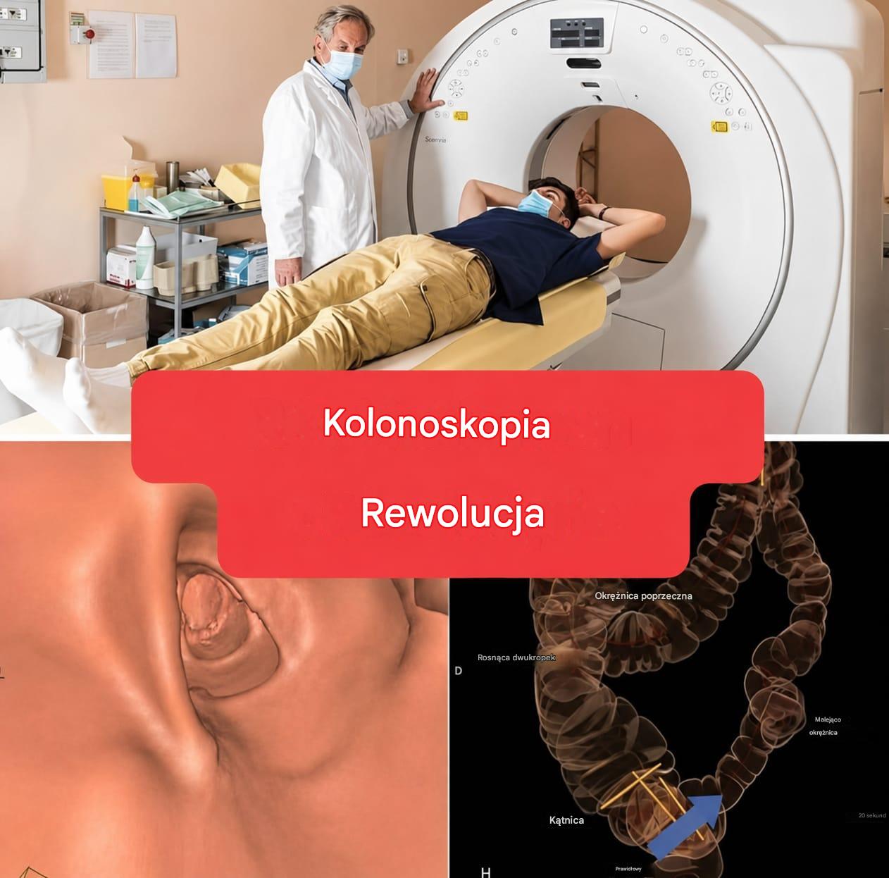 Nowa metoda: Kolonoskopia nie będzie już badaniem inwazyjnym. (1/2)