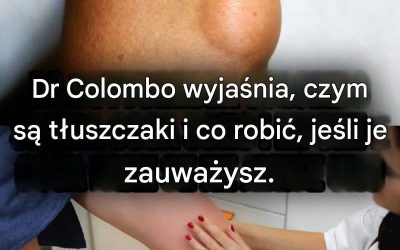 Dr Laura Colombo wyjaśnia, czym są tłuszczaki i co robić, jeśli je masz (1 / 2)