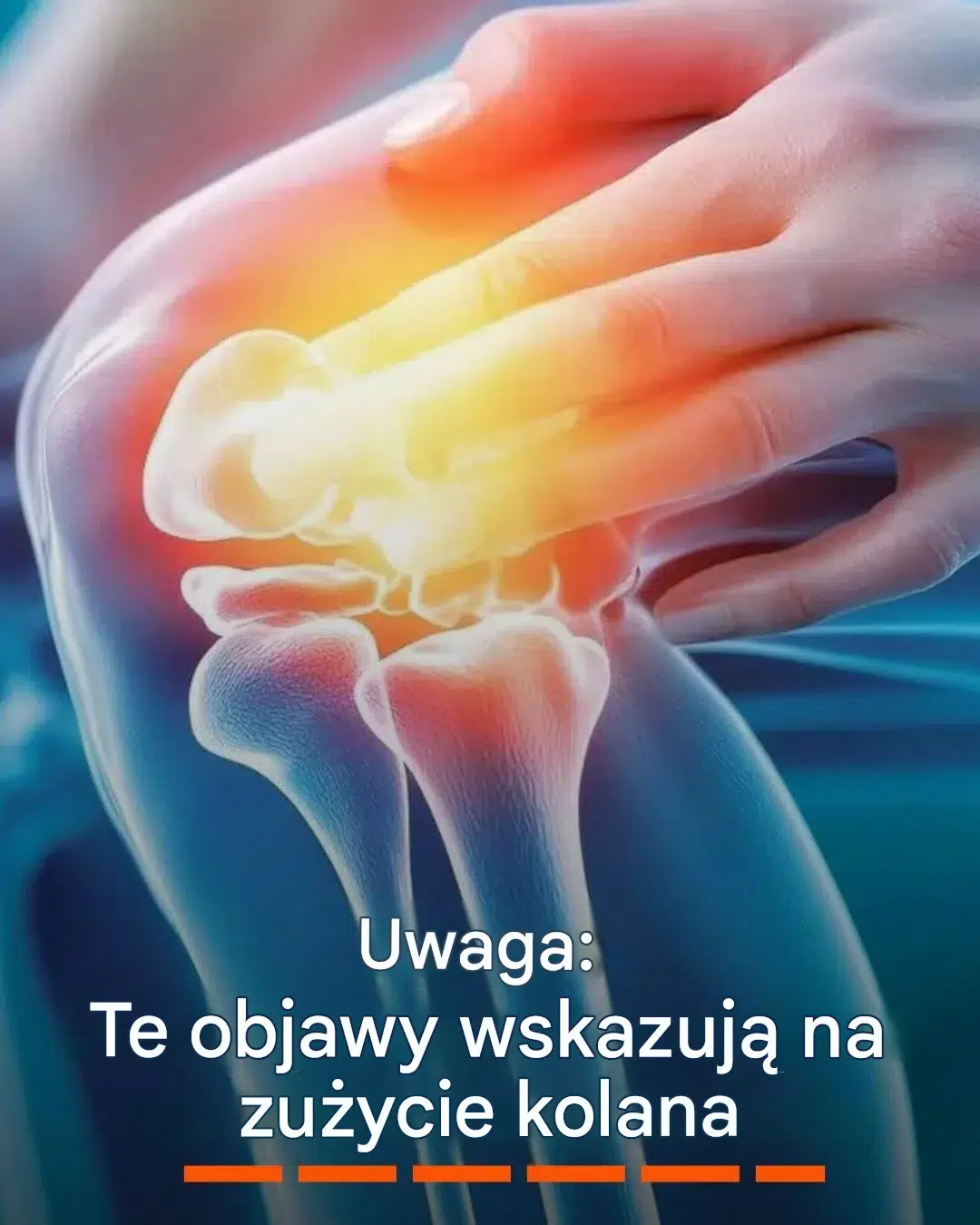 Uwaga! Te objawy wskazują na zużycie kolana.