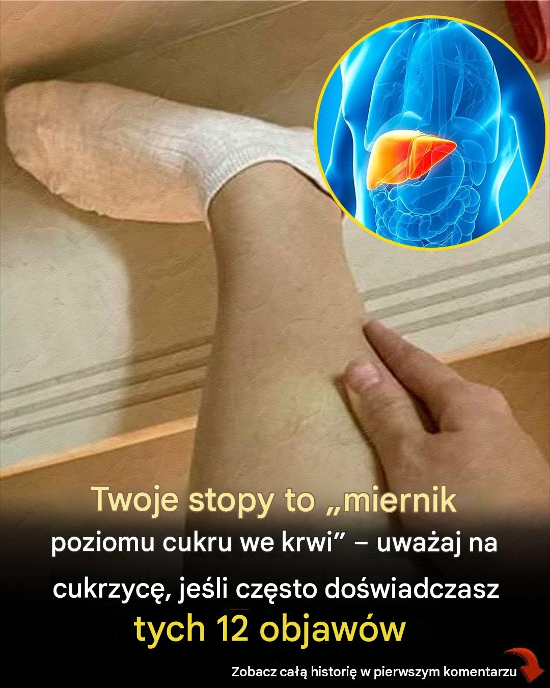 Twoje stopy to „miernik poziomu cukru we krwi” – ​​uważaj na cukrzycę, jeśli często doświadczasz tych 12 objawów