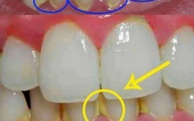 Usuń płytkę nazębną naturalnie w 5 minut, bez wizyty u dentysty.