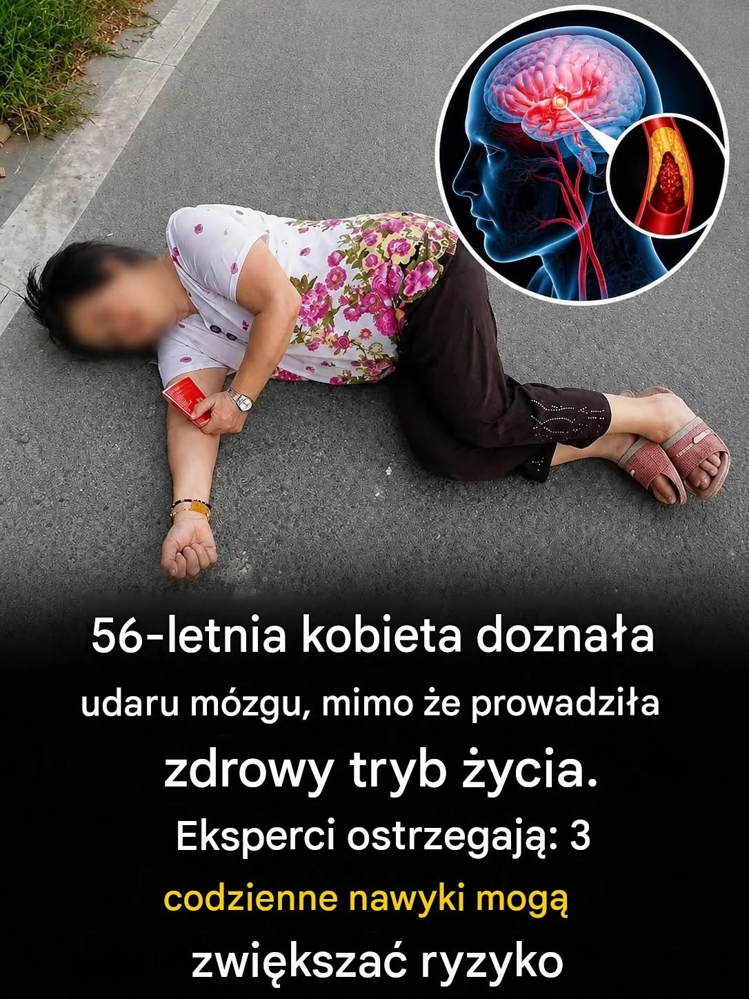 56-letnia kobieta doznała udaru mózgu po latach zdrowego odżywiania i ćwiczeń: Lekarze ostrzegają przed trzema nawykami, które wiele osób ignoruje.